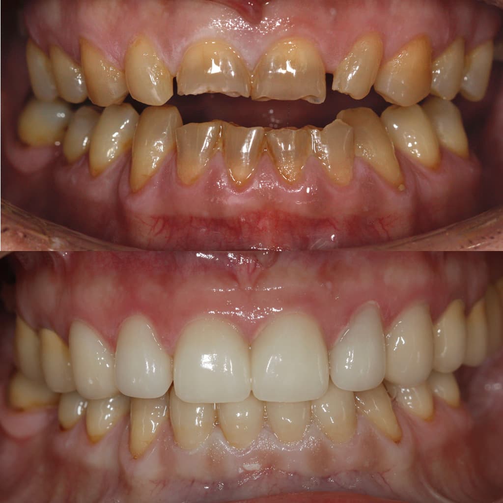 Trabajos de estética dental en Álvarez Uriarte & Cameselle