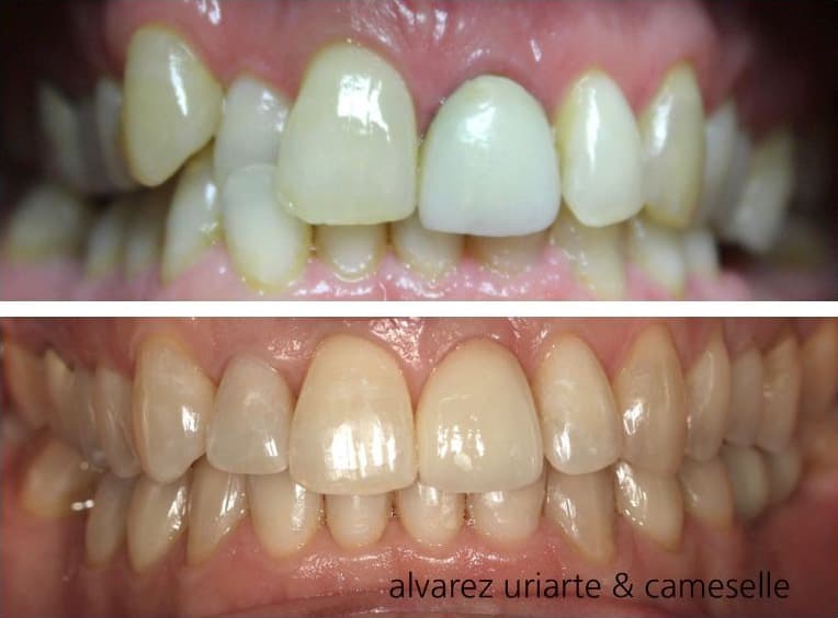 Trabajos de ortodoncia en Álvarez Uriarte & Cameselle