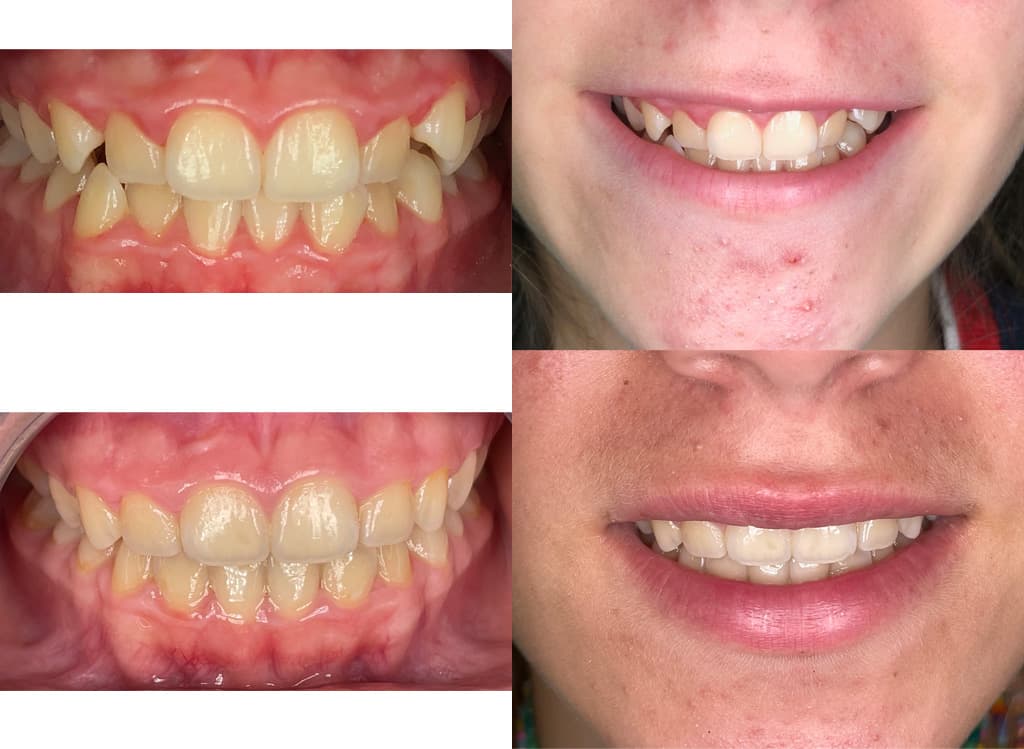 Trabajos de ortodoncia en Álvarez Uriarte & Cameselle