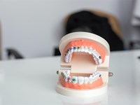 ¿Por qué es importante comenzar el tratamiento de ortodoncia en niños?